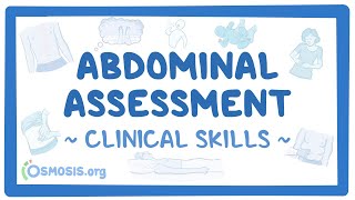 Abdominal Assessment Clinical Skills [upl. by Bick700]