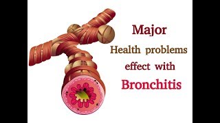 Bronchitis  How to treat Bronchitis Naturally [upl. by Clovah]