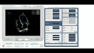 wwwmyechocardiographycom [upl. by Yrailih547]