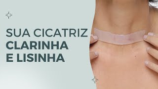 COMO FUNCIONA A FITA DE SILICONE PARA CICATRIZ SUPÉRBIA [upl. by Lletnuahs457]