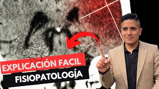 ✅Ictus Isquémico Fisiopatología 1 ABP Adulto Séptimo🧠 [upl. by Stanley]