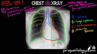 How to Interpret a Chest XRay Lesson 1  An Introduction [upl. by Namaj]