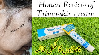 Trimoskin cream Review  Remove Pigmentation Remove Dark Spots  Honest Review of Trimo Skin Cream [upl. by Flight]