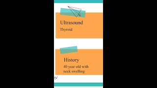 Thyroid ultrasound  SpotTheDiagnosis [upl. by Aelem]