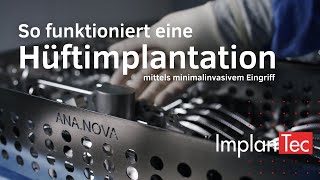 So funktioniert eine Hüftimplantation HüftOP mittels minimalinvasivem Eingriff [upl. by Katya]