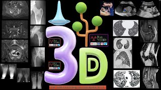 TOP THREE DIFFERENTIAL DIAGNOSIS SET II [upl. by Thetisa]