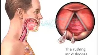 How Do We Cough  The Mechanism of Coughing  Cough Reflex Animation  Learn Human Body [upl. by Omsoc]