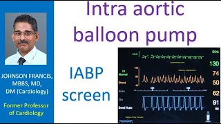 Intra aortic balloon pump [upl. by Avot]