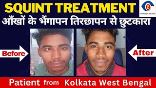 भेंगेपन का इलाज Strabismus Surgery Or Squint Surgery Treatment Happy Review Patient Review In Hindi [upl. by Sloan]