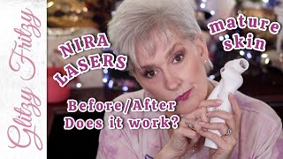 NIRA LasersLies 90 days 61 Year Mature Skin notsponsored [upl. by Sobmalarah]