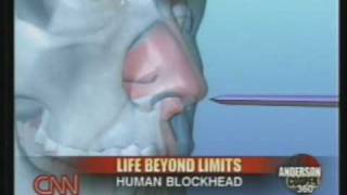 Human Blockhead Explained on CNN [upl. by Linzer]