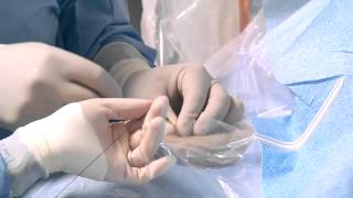 Transradial Cardiac Catheterization [upl. by Baiel]