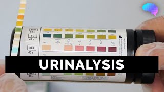 Urinalysis  OSCE Guide old version  UKMLA  CPSA [upl. by Inaej79]