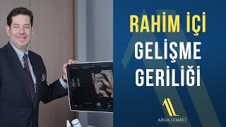 Rahim İçi Gelişme Geriliği  Prof Dr Arda Lembet [upl. by Aninotna]