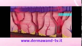 Dermawand video ufficiale [upl. by Leone894]