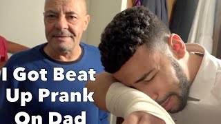 I Got Beat Up Prank On Protective Dad [upl. by Nikolaus]