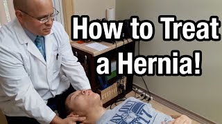 Hiatal Hernia Relief Technique [upl. by Bonucci]