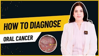 How to Diagnose Oral Cancer  Clinical Exams Biopsies and Imaging Tests Explained  Dr Sharmin [upl. by Luigino844]