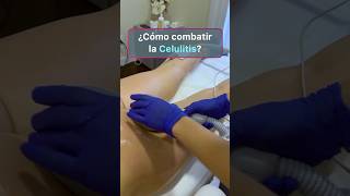 Consejos para reducir o eliminar celulitis rápidamente celulitis grasalocalizada [upl. by Darce]