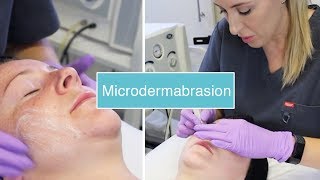 Microdermabrasion  The Laser and Skin Clinic [upl. by Guttery]