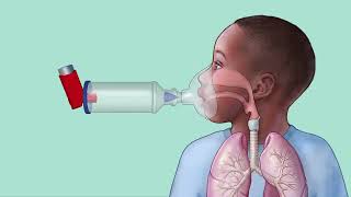 Pasos para usar el inhalador con espaciador y Máscara [upl. by Slosberg]