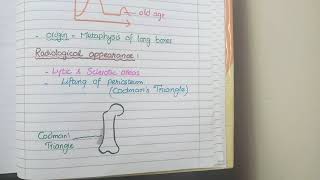 Osteosarcoma Pathology [upl. by Otnicaj]