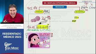 RM 2023 Ginecología 11 Neoplasia intraepitelial cervical [upl. by Ahsimrac854]