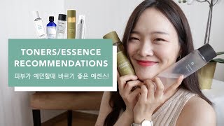 Best Calming Toners amp Essence for Angry Sensitive Skin  TOP 5 [upl. by Inad181]