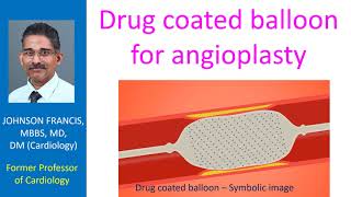 Drug coated balloon for angioplasty [upl. by Aubreir]