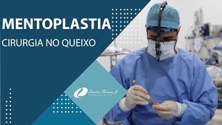 MENTOPLASTIA TUDO SOBRE A CIRURGIA PLÁSTICA PARA REMODELAR AUMENTAR OU DIMINUIR O QUEIXOMENTO [upl. by Mclaurin592]