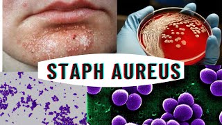 Staphylococcus aureus  staphylococcus infection  causes symptoms [upl. by Stanfield]