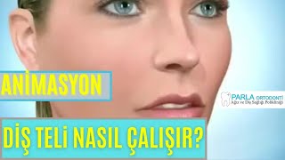 DİŞ TELLERİ NASIL ÇALIŞIR  ANİMASYON [upl. by Atekihs]