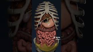 Ascites secondary to liver disease [upl. by Philander129]