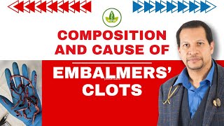 Embalmers Clots EXPOSED Whats Really Causing Them [upl. by Ignace]