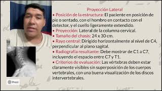 Proyecciónes de la Columna Cervical  José Carlos Salazar Arias [upl. by Eramal]