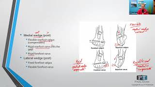 Forefoot and Rearfoot Deformities [upl. by Eves62]