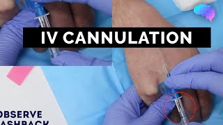 Intravenous IV cannulation  OSCE Guide  UKMLA  CPSA [upl. by Jentoft890]