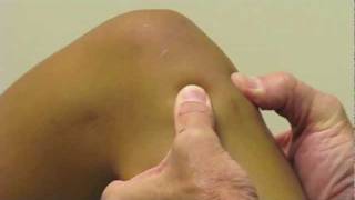 ACL Exam Lachmans Test Pivot Shift Drawer Test performed by Dr Eric Janssen [upl. by Ephram]