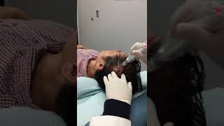 MicroNeedling for Hair Loss [upl. by Sotnas]