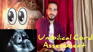 Level 3  Female pelvis  Obs  Scanning  Assessment Of Umbilical Cord [upl. by Airogerg]