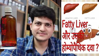 Fatty liver  Homeopathic Medicine for Fatty liver  My Combination [upl. by Girovard]