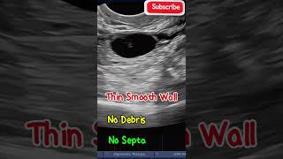 Best Follicle to Conceive ultrasound pregnancy [upl. by Whall226]