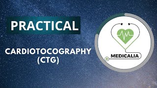 Cardiotocography  CTG   Part 1 [upl. by Pompea887]