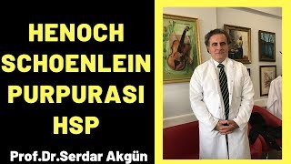 Henoch Schonlein Purpurası HSP Serdar Akgün [upl. by Grayce]