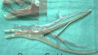 MediFax This Week in Neurosurgery  Surgical Instruments for Lumbar Spine [upl. by Saqaw]