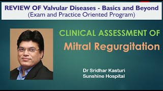 Clinical assessment of Mitral Regurgitation Dr Guru Chaithanya [upl. by Michal]