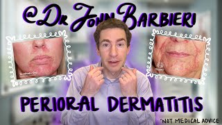 Dermatologist Explains Perioral Dermatitis How to Identify Causes amp Treatment [upl. by Honebein259]