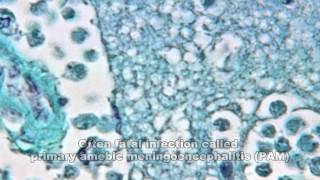 Naegleria fowleri What You Need to Know [upl. by Coheman825]