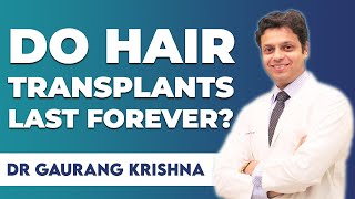 2024 How long do Transplanted Hair last  Is Hair Transplant Permanent Medlinks Delhi [upl. by Okuy983]