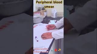 Peripheral blood smear PBS dmlt medical lab 🔬🩸✨ [upl. by Adnohser]